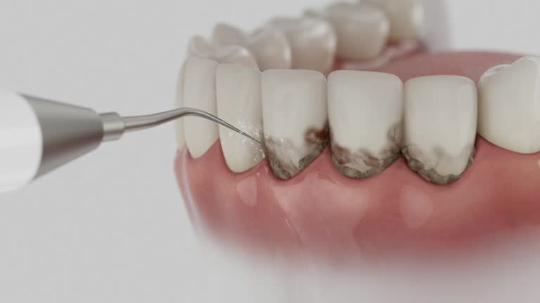 Trusted Dental Implants service in Hamilton, AL - Dentist Open Now